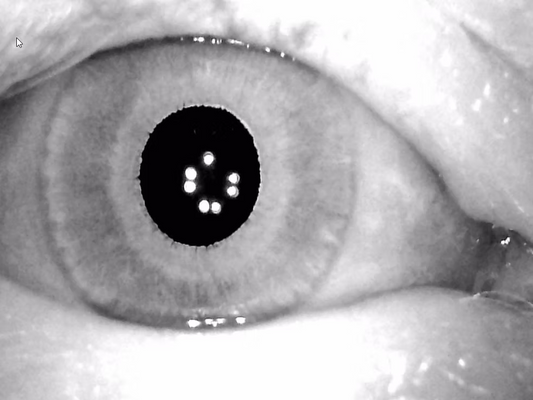 The clinical relevance of SHIMP testing