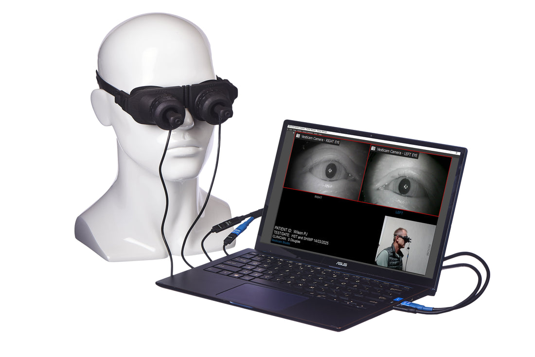 Are we observing eye movements well enough?
